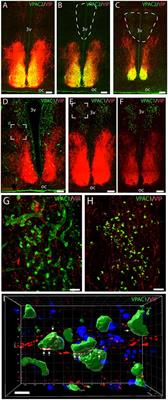 Localization of Vasoactive Intestinal Polypeptide Receptor 1 (VPAC1) in Hypothalamic Neuroendocrine Oxytocin Neurons; A Potential Role in Circadian Prolactin Secretion